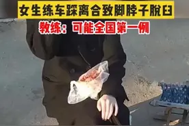 山东：一女生练车踩离合用力过猛，脚崴了，教练说她是中国第一例图片