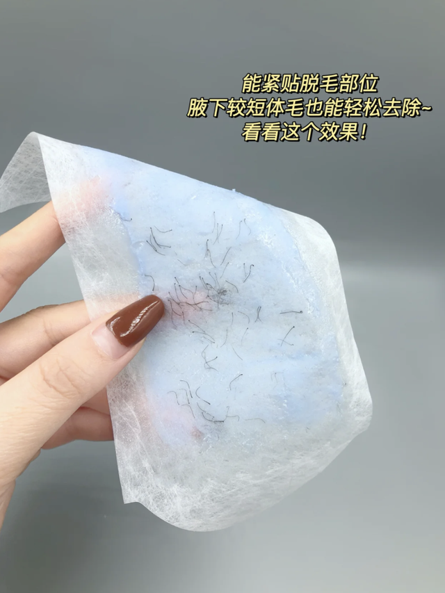 冰点脱毛以后可以擦身体乳吗