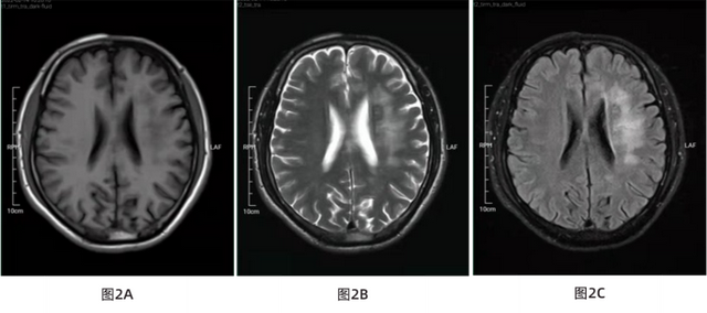 额头上鸡皮肤图片大全