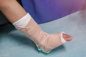 接骨疗伤、化瘀止痛，常用的7种骨伤科中成药图片