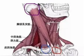 宝宝脖子总往一个方向歪，可能是小儿肌性斜颈图片