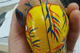 有心脏病？到底是啥心脏病？图片