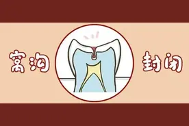 这几个年龄段做窝沟封闭最有效，快看看你家娃错过了没？图片