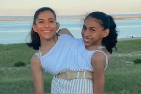 22岁的连体双胞胎姐妹，共享生殖系统，其中一个已交往男朋友两年图片