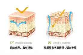 脸上的色斑到底是怎么形成的？怎么办？告诉你一个彻底祛斑的方法图片