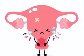 打破3个70%！卵巢癌患者如何改善生存？图片