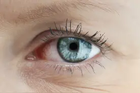 如果您的眼睛有这个表现，请检查您的甲状腺图片