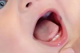 疼…疼…疼这8个信号我要出牙了，宝妈们别忽视图片