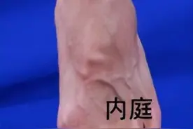 体内有疾头先知，脑勺疼，偏头疼，不同位置的头疼原来因为它图片