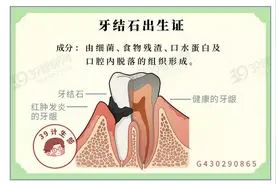 牙齿上的“小石头”，怎么去除好得快？真正有用的方法是这2个图片