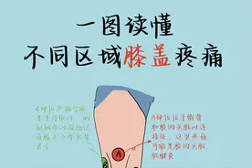 膝盖不同区域疼痛原因速查，一图读懂！图片