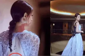 谢霆锋的手，赵丽颖的血栓，张嘉译的背，打了多少明星的脸？图片