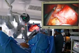 警惕！切除子宫和卵巢会给年轻女性带来更多的CVD风险图片