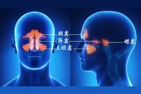 如何区分急性鼻窦炎和慢性鼻窦炎？图片
