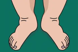 我只是肿了，不是胖了……真人示范按摩消肿动作图片