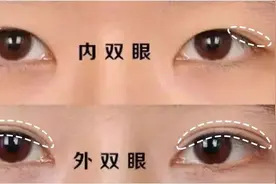 如何辨别自己是内双眼皮，怎么做才能变成双眼皮图片