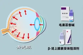 青光眼，能治好吗？图片