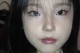 长沙女孩右眼天生蓝色一度自卑，网友暖心回复：异瞳超酷图片