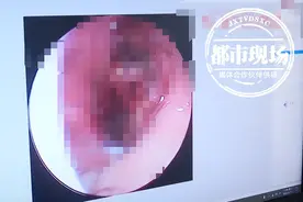 “鼻子老不通气”以为是鼻炎，结果拖成癌！专家提醒：这些情况要注意图片