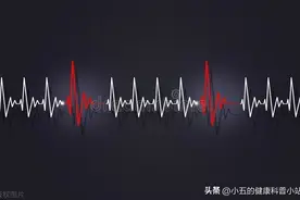 益气养阴，活血化瘀，聊一聊治疗快速心律失常的中成药-稳心颗粒图片