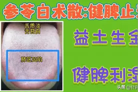 参苓白术散(丸):舌象表现及功效图片