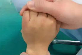 偏瘫后,上肢抬不起来,手没有功能,肿胀松弛,快来试一试这20个动作图片