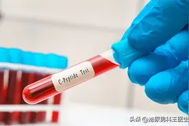 尿酸高是吃出来的？医生提醒：3种高嘌呤食物，以后要少吃些图片