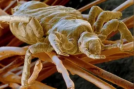 几十年前人人都长有的虱子，为何现在不见了？虱子哪里去了？图片