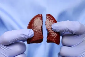 体检报告中的肺结节，如若出现这几个字眼可能是癌图片