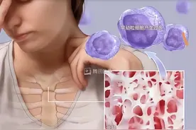 急性早幼粒细胞白血病可以用砒霜治愈，“以毒攻毒”！是真的吗？图片