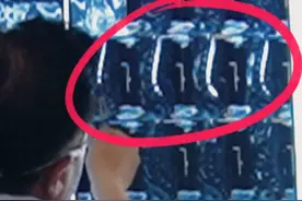 双腿疼痛站不住，可能是它导致的！#健康守护计划图片