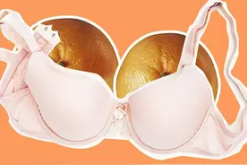 乳晕长了小疙瘩，正常吗？难不成是乳腺癌图片