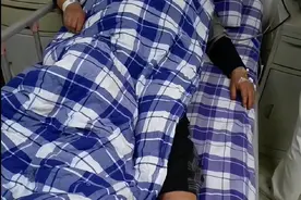 重庆一小猫叼回毒蛇咬伤主人 专家：疑似“烂肉王”，致死量50毫克图片