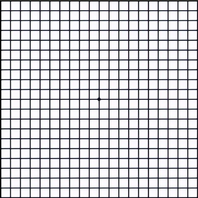 四张眼科测试,花1分钟自测眼睛是否健康