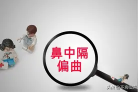 鼻中隔偏曲手术图片