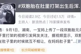 双胞胎肚里打架出生后浑身淤青？产科医生：都不在一个“房间”图片