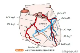 冠脉解剖图片