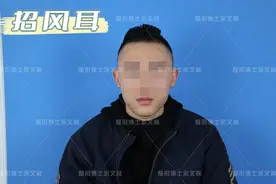 「科普」招风耳是一种福相吗？耳畸形修复医生：反而是种畸形图片