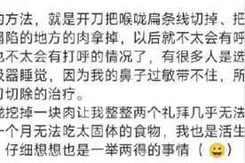 知名女星打呼患睡眠暂停综合征冲上热搜，打呼为何如此严重？图片