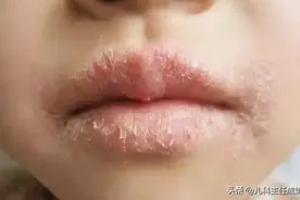 马蹄煮水巧搭配，缓解孩子各种干燥，喝它比喝水管用！图片