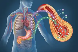 “癌王”胰腺癌，很多人误以为是胃病！出现5个症状，及时就医图片