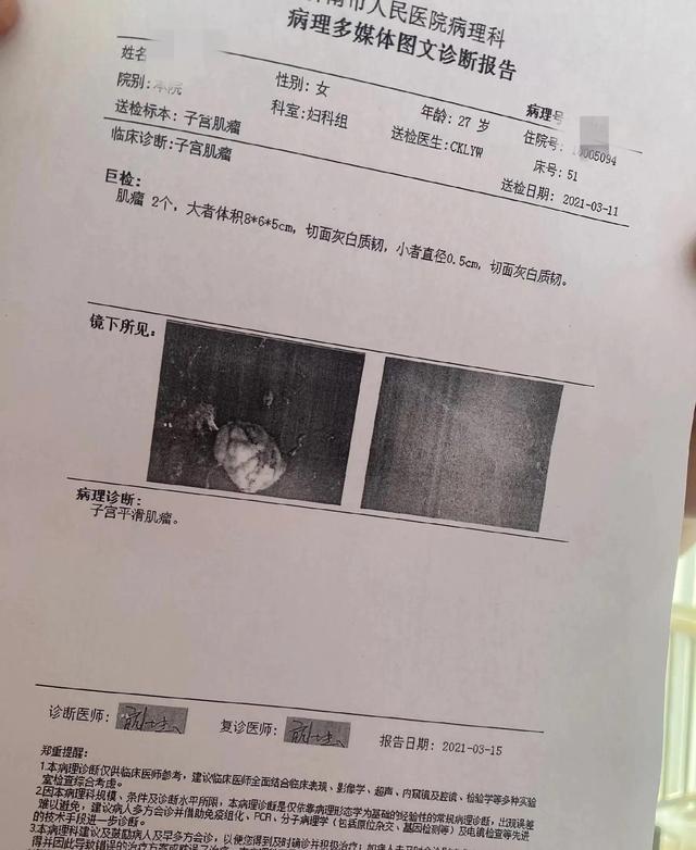 记录我的子宫肌瘤手术及其费用（有男友）