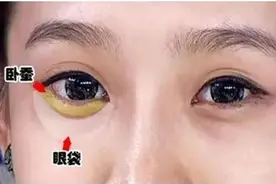 卧蚕和眼袋有啥区别？这篇都说清楚了图片