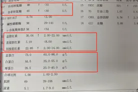 乙肝患者定期复查，有这5种情况，一定要排查肝癌图片