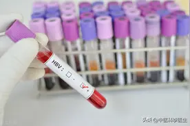 国产在研乙肝新药HH-003，有哪些优势？能根治乙肝吗？图片