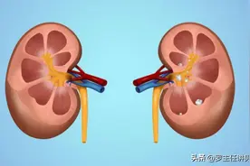 真的有药物可以溶解肾结石吗？图片