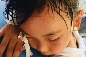 孩子出汗多、瘦小不长肉，1个经典方气阴双补图片