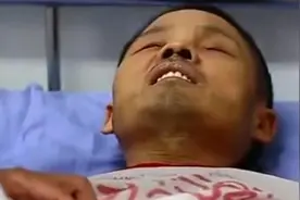 湖北男子腹痛难忍，医生发现腹中不见任何脏器，切开腹腔真相大白图片