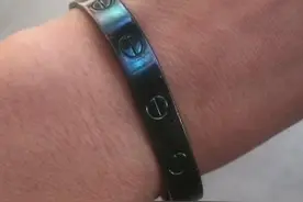 女子退烧后发现银手镯“变黑”，医生：经常出汗会加快手镯变黑速度图片