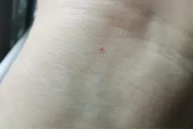 手腕的朱砂痣图片